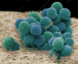 Staphilococcus epidermidis